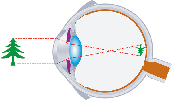 Retinal image diagram from cognitive psychology